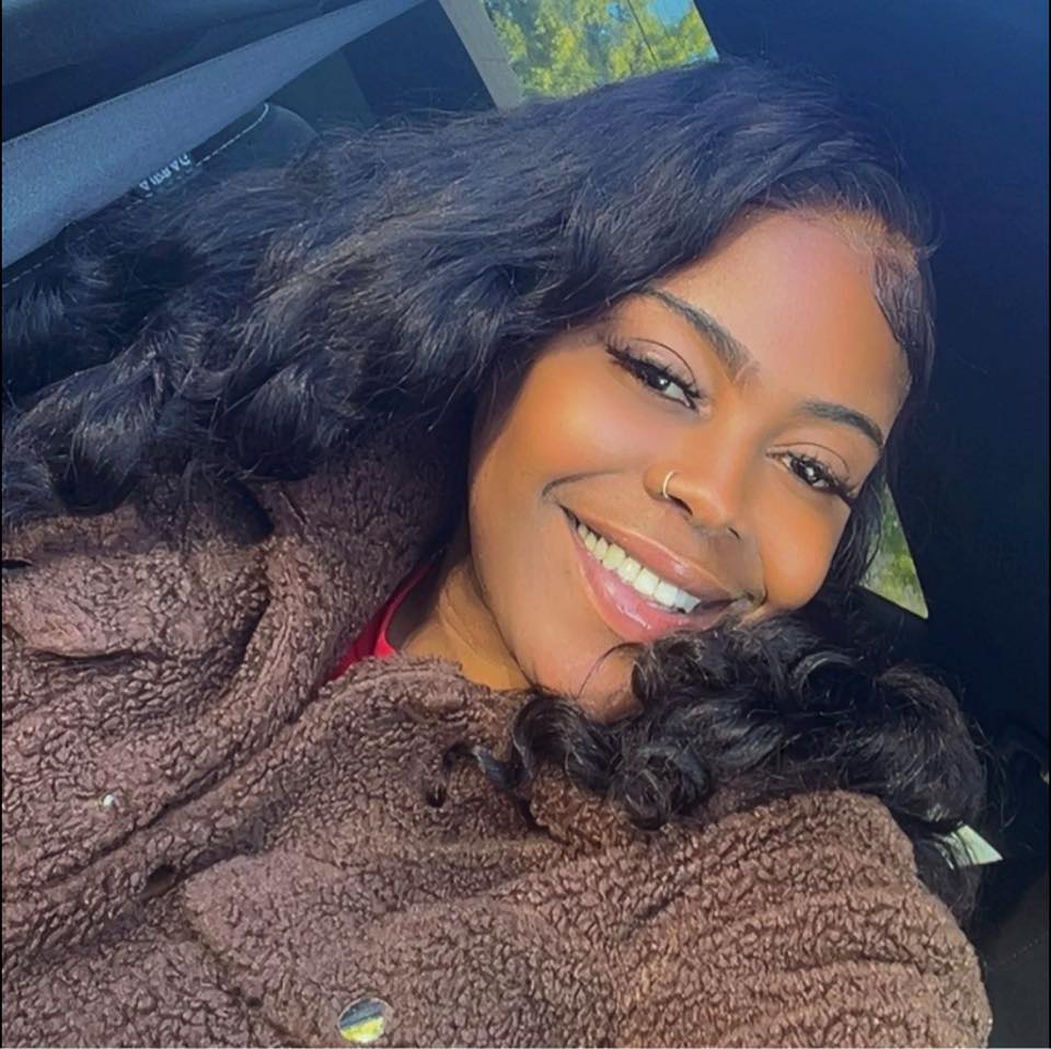 My baby face is breaking out what to do - Shador Blackwell | Facebook