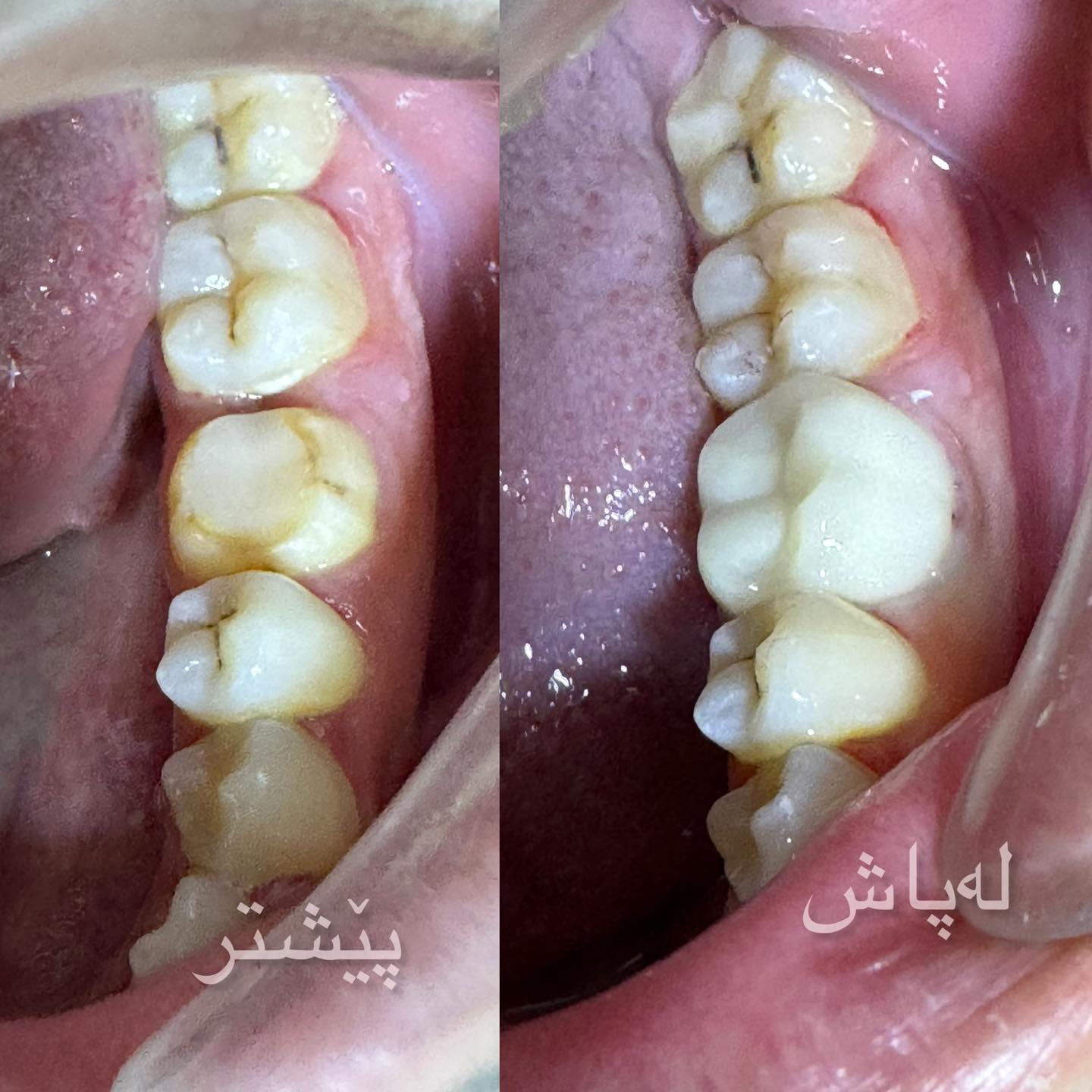 پزيشكي ددان/د.زاگروس عادل ياور Dr. Zagros Adil Yawer | Kalar