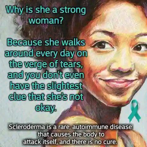 Scleroderma Warriors – Care & Support | Is Crest Syndrome the same as ...