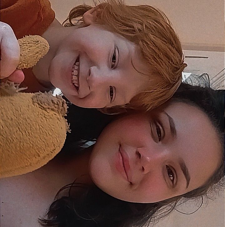 Craniosynostosis Awareness | We have not been diagnosed however, I am ...