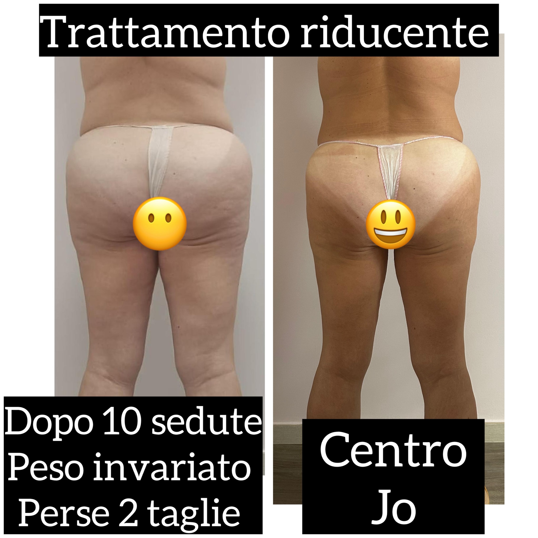 J O Centro Studi Estetica di Gianna Ritoli | Cassano delle Murge
