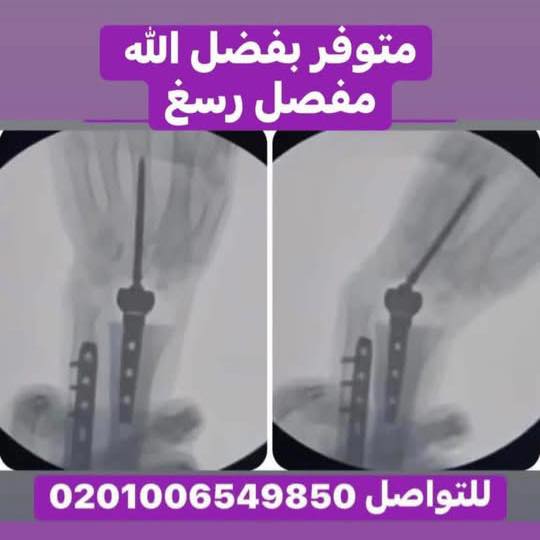 اويست ميد اويست مبد