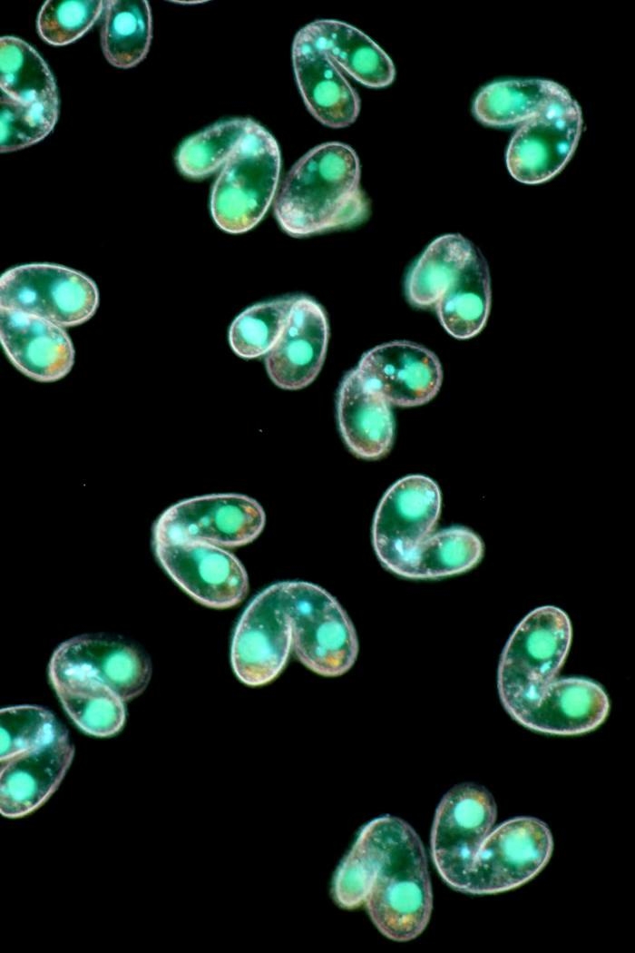 Amateur Microscopy | Paramecium Microscope 100X + Huawei telephone ...