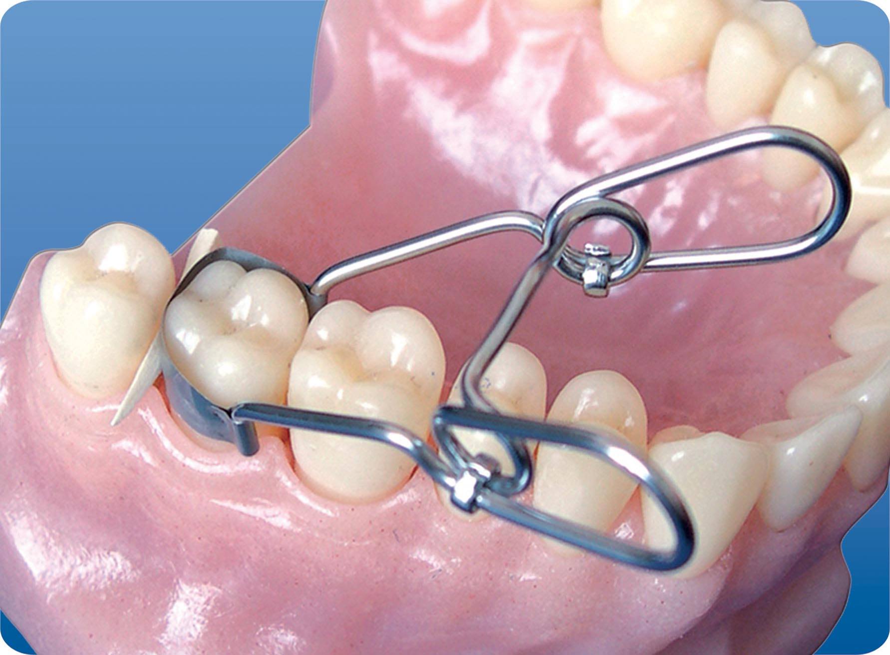 matrici-dentare-bacau