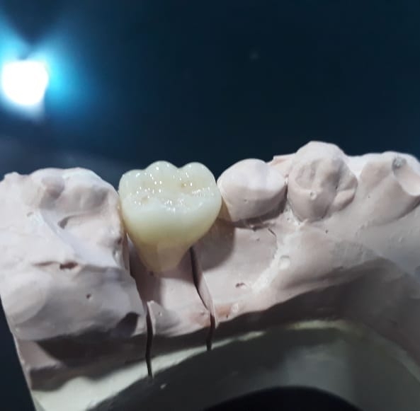 Hadent Laboratorio Dental