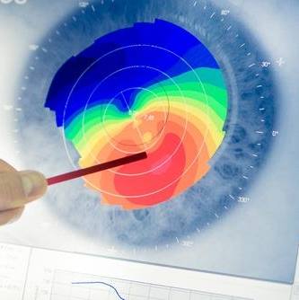 Azman Eye Care Specialists | Baltimore MD