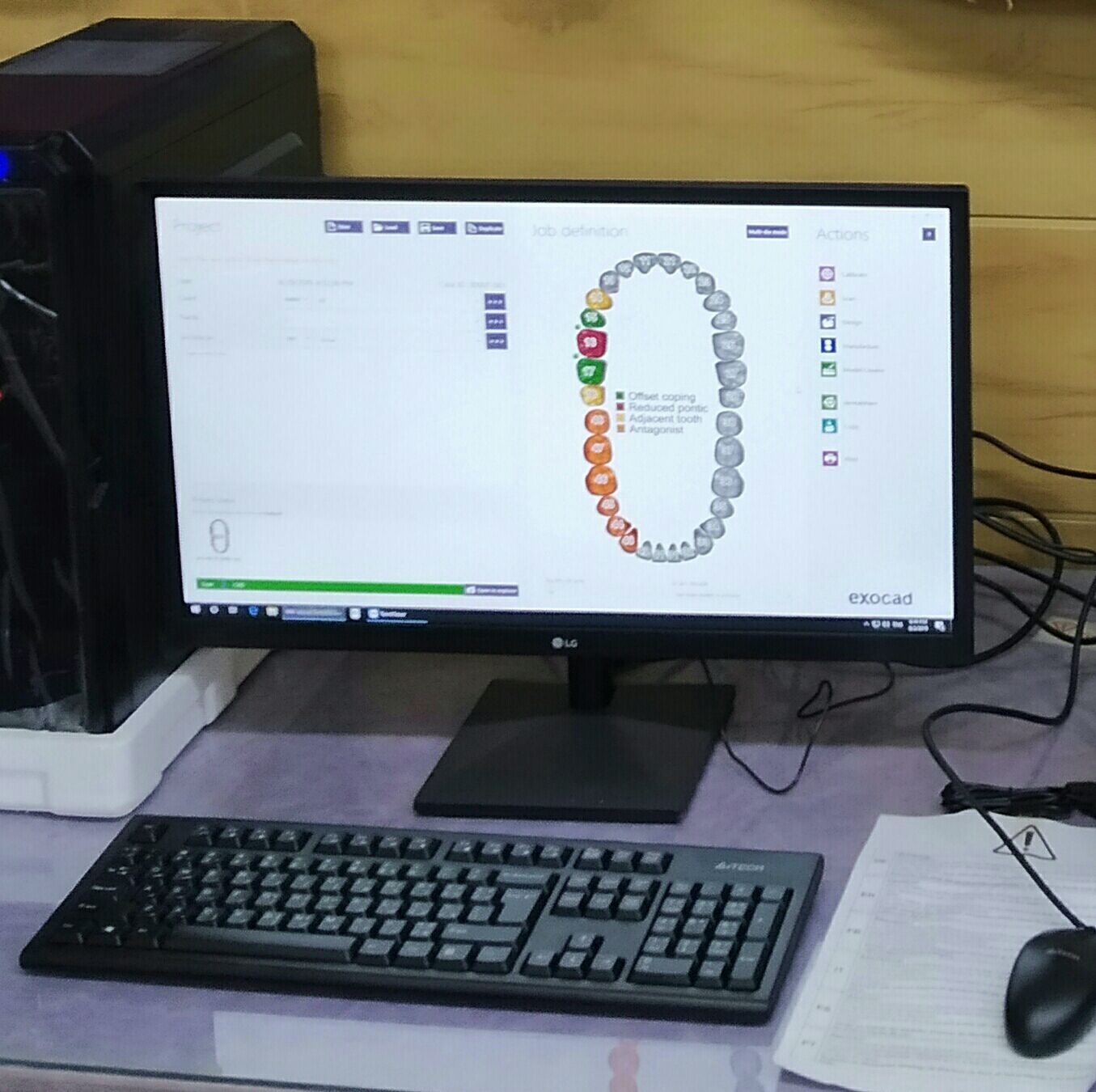 Osama digital dental lab | Homs