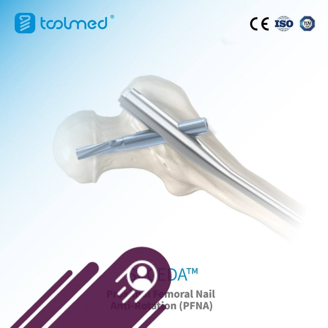 Beyond Trauma: Versatile Reconstruction. From traumatic fractures to ...