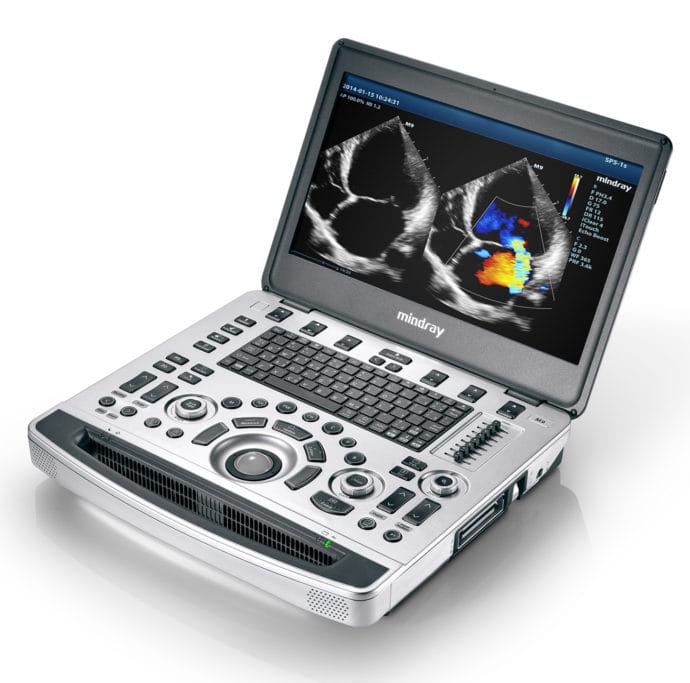 Digital Ultrasonogram Machine ডিজিটাল আল্ট্রাসনোগ্রাম মেশিন added a new ...