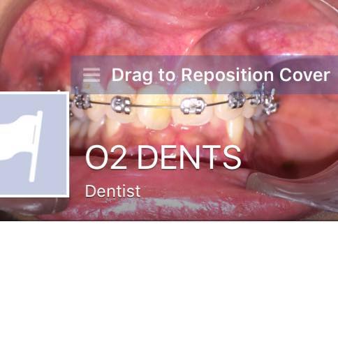 O2 DENTS | Mumbai