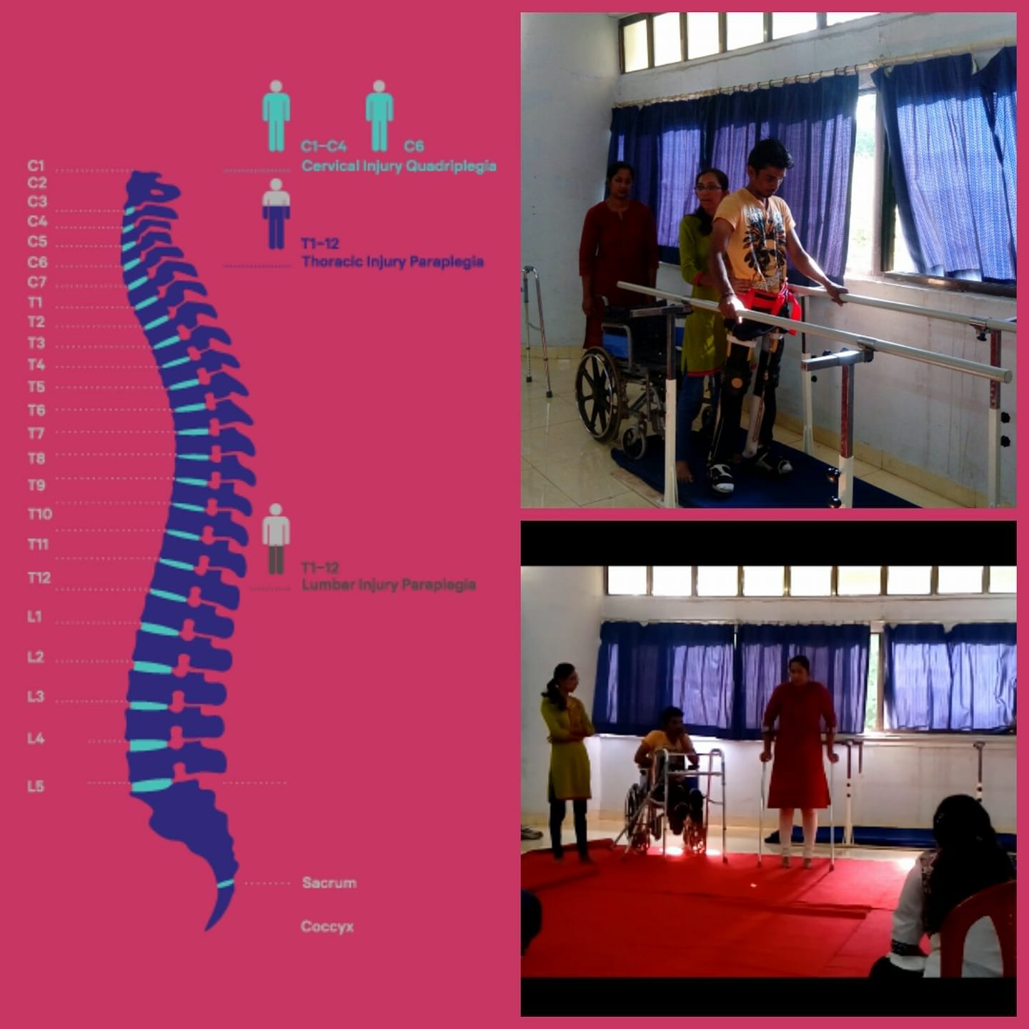 Spinal Cord Injury Rehabilitation