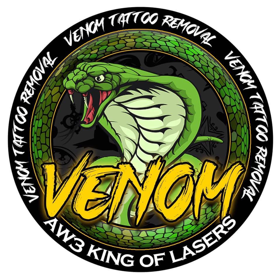 Venom Tattoo Removal