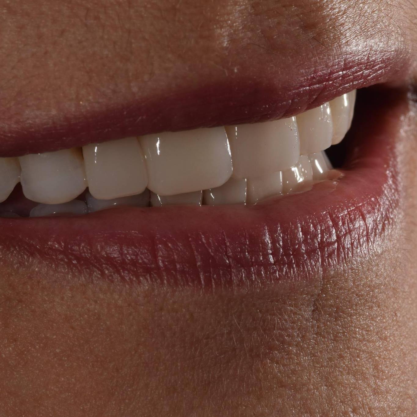 Hernandez-Paulo Dental Group - Tratamientos Invisaling#DraPaulo | Facebook