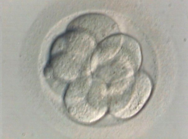 IVF at Walter Reed (The ART Institute of Washington, Inc.) - Baby ...