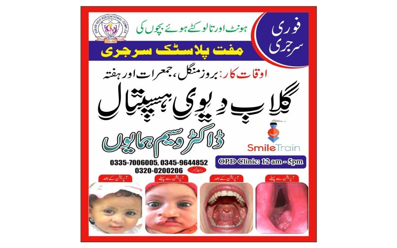 Free surgery of cleft lips and cleft palate available in lahore