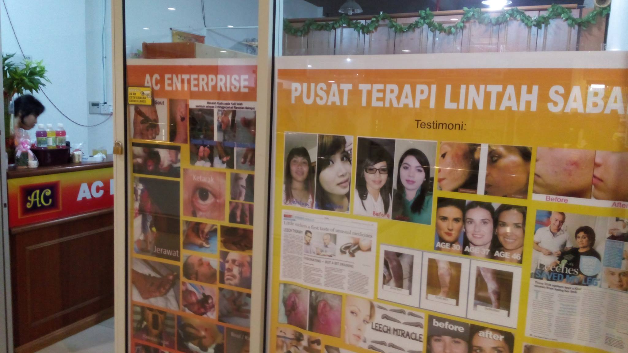 Pusat terapi lintah sabah | Kota Kinabalu