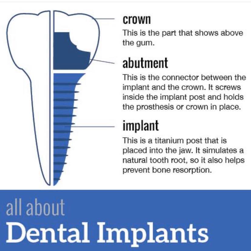 Edinger Dental | Santa Ana CA