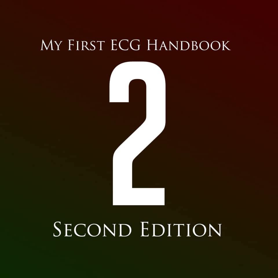 My First ECG Handbook