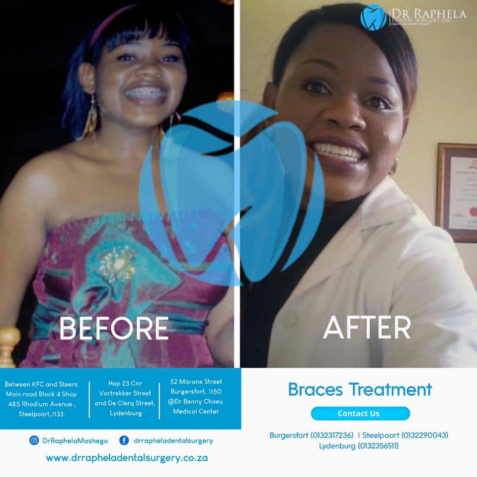 Dr Raphela Dental Surgery | Burgersfort