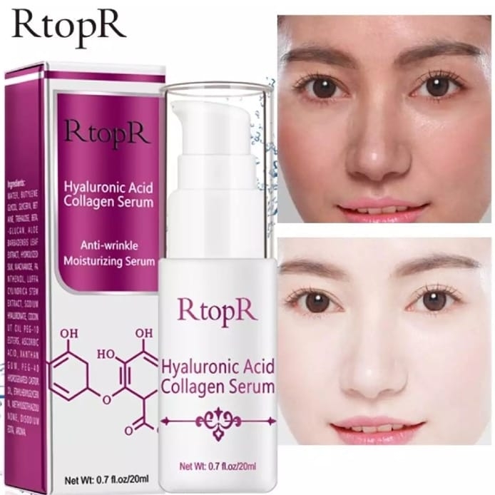 Agen RtopR Original
