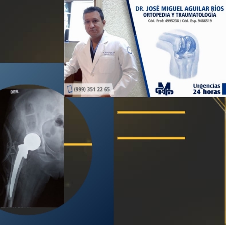 Dr Miguel Aguilar Rios Traumatología y Ortopedia Mérida - Noviembre de ...