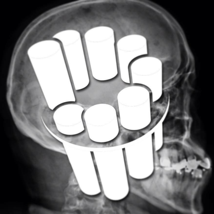 22 Neuroradiology Cases... - Neuroradiology - Radiopaedia.org | Facebook