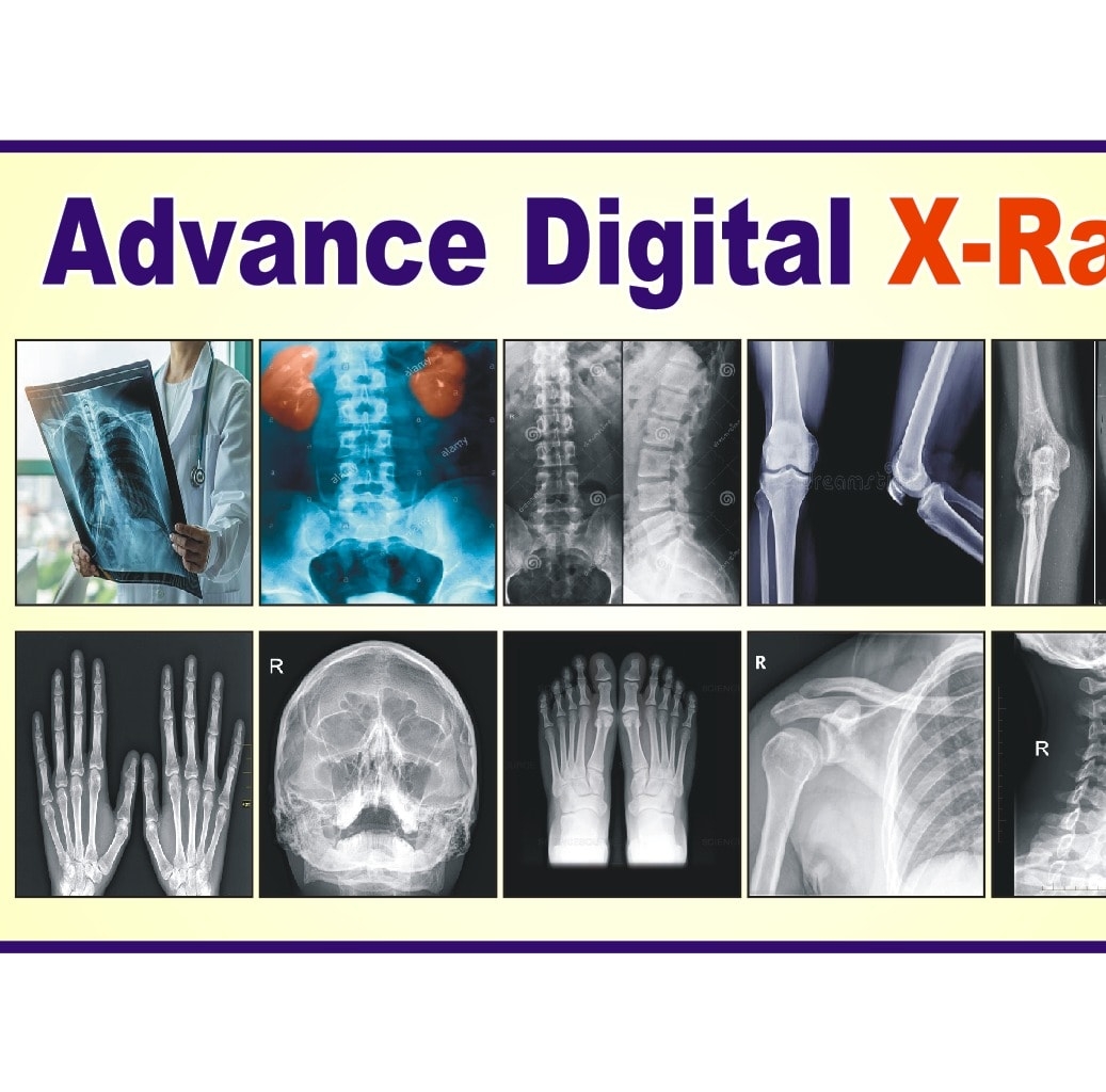 Advance Digital X-Ray Bara | Khyber