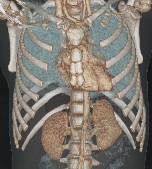 Radiology Case Cafe