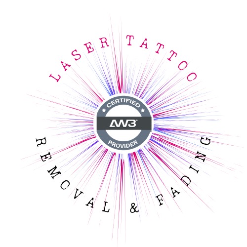 Laser Tattoo Removal Cirencester - Everlasting impressions | Cirencester