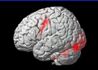 NIMLab - NeuroImaging and Modulation Laboratory | Baltimore MD
