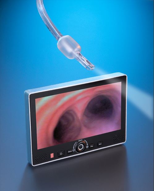Alcindo alciairway