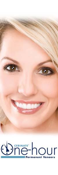 Cerinate One-hour Permanent Veneers