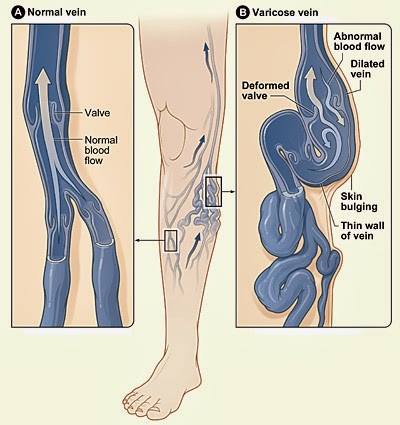Vascular Surgeon Dr Nitin Pathak | Pune