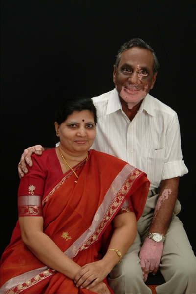 Dr. Gattu Ranga Rao Foundation