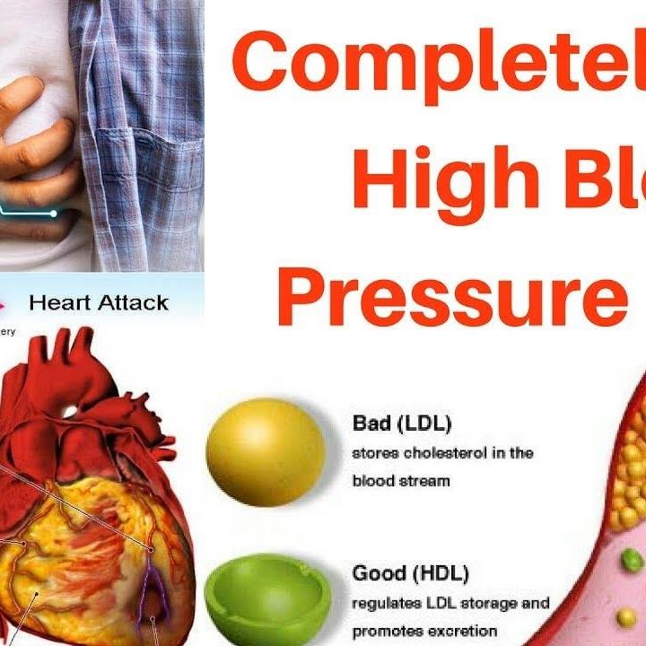 Healthstep - WHAT IS A STROKE A stroke occurs when blood supply to the ...