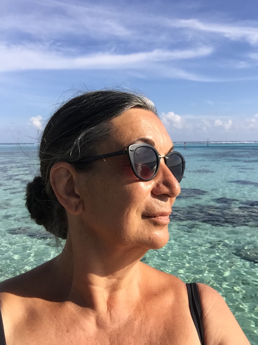 Blepharoplasty Support Group | Did anyone else's eyes look so different ...