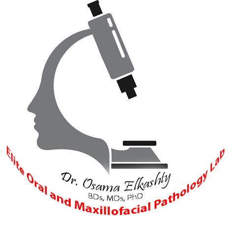 Elite Lab - Dr. Osama Elkashty Oral & Maxillofacial Pathology lab ...