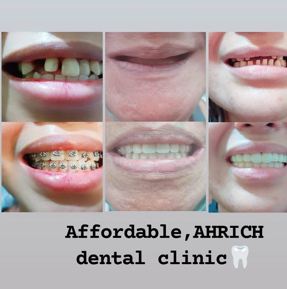 Affordable , Ahrich dental clinic and laboratory