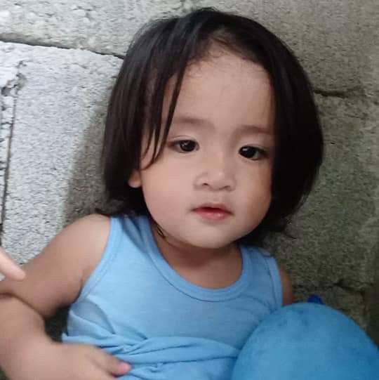 USAPANG GALLSTONES / BATO SA APDO / CHOLELITHIASIS / LAP CHOLE / OPEN ...