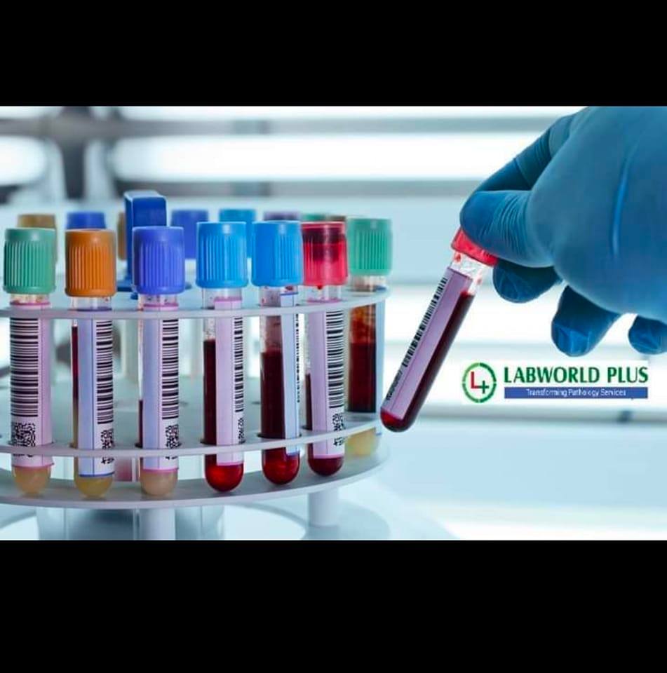 Haider laboratory wah cant | Wah