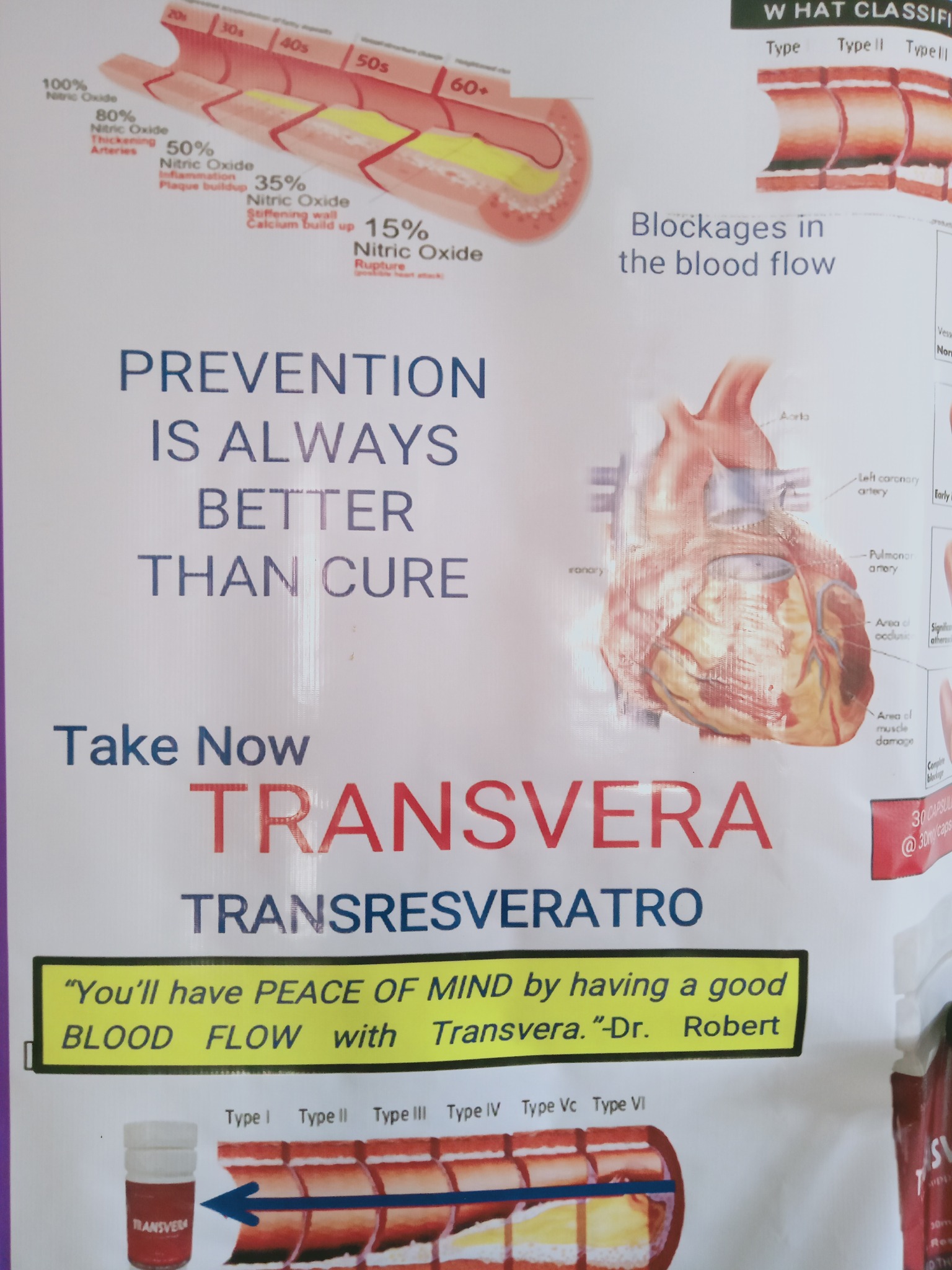 Transvera Negros | Bindoy