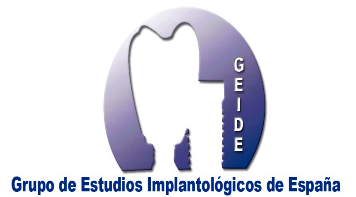 GEIDE
