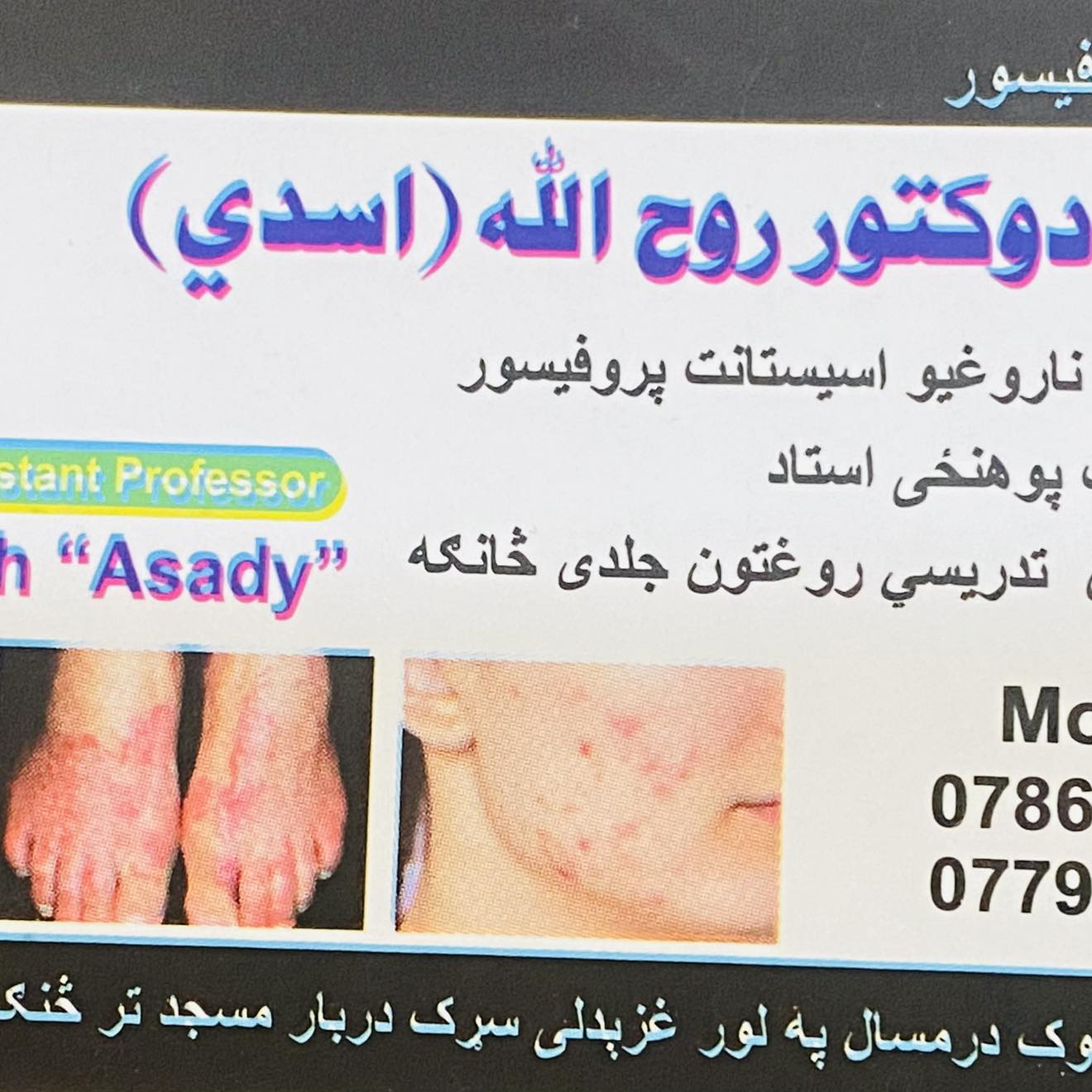 Dr: Rohullah Asady Dermatology & Aesthetic Clinic | Jalalabad