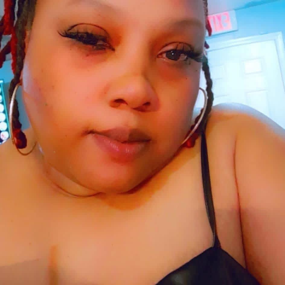 Brenda Mcnure - Dr. Said my fractures should be healed in... | Facebook