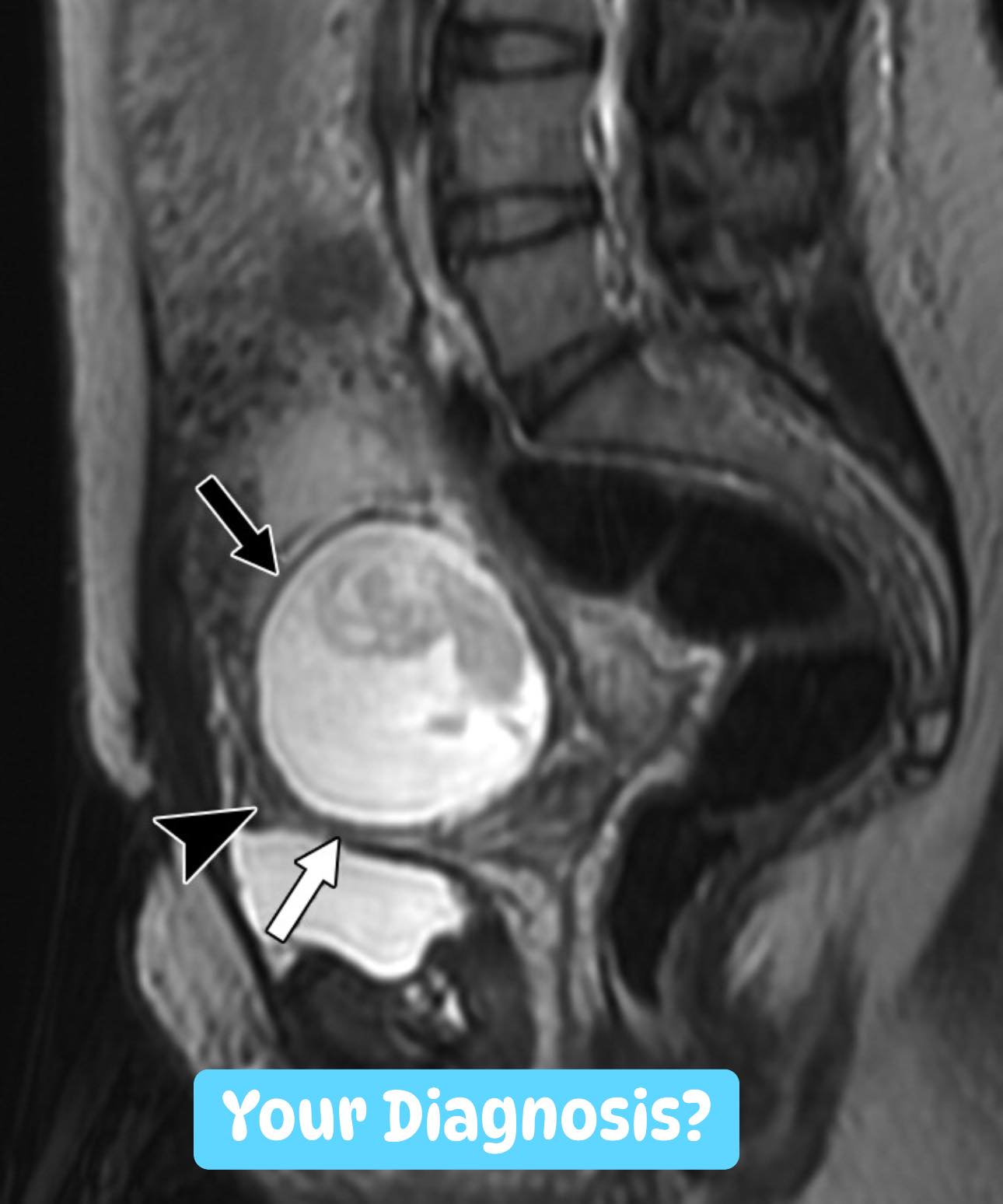 Medical - A 30-year-old woman presents with abdominal pain and vaginal ...