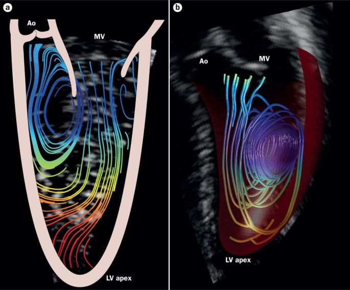 Chiaseyhoc.vn - 🌀 Vortex of Heart – Xoáy tim: Sinh lý học... | Facebook
