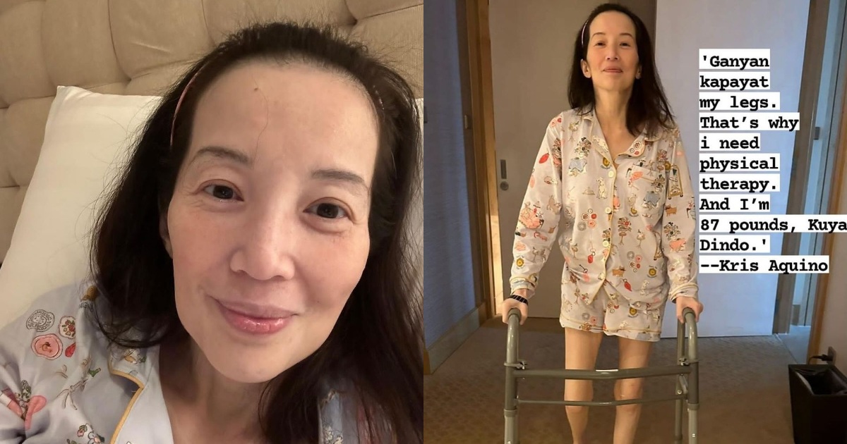 kris aquino glutathione ICYMI: struggled with bone pain while shooting comeback content Frontiers | The lactate