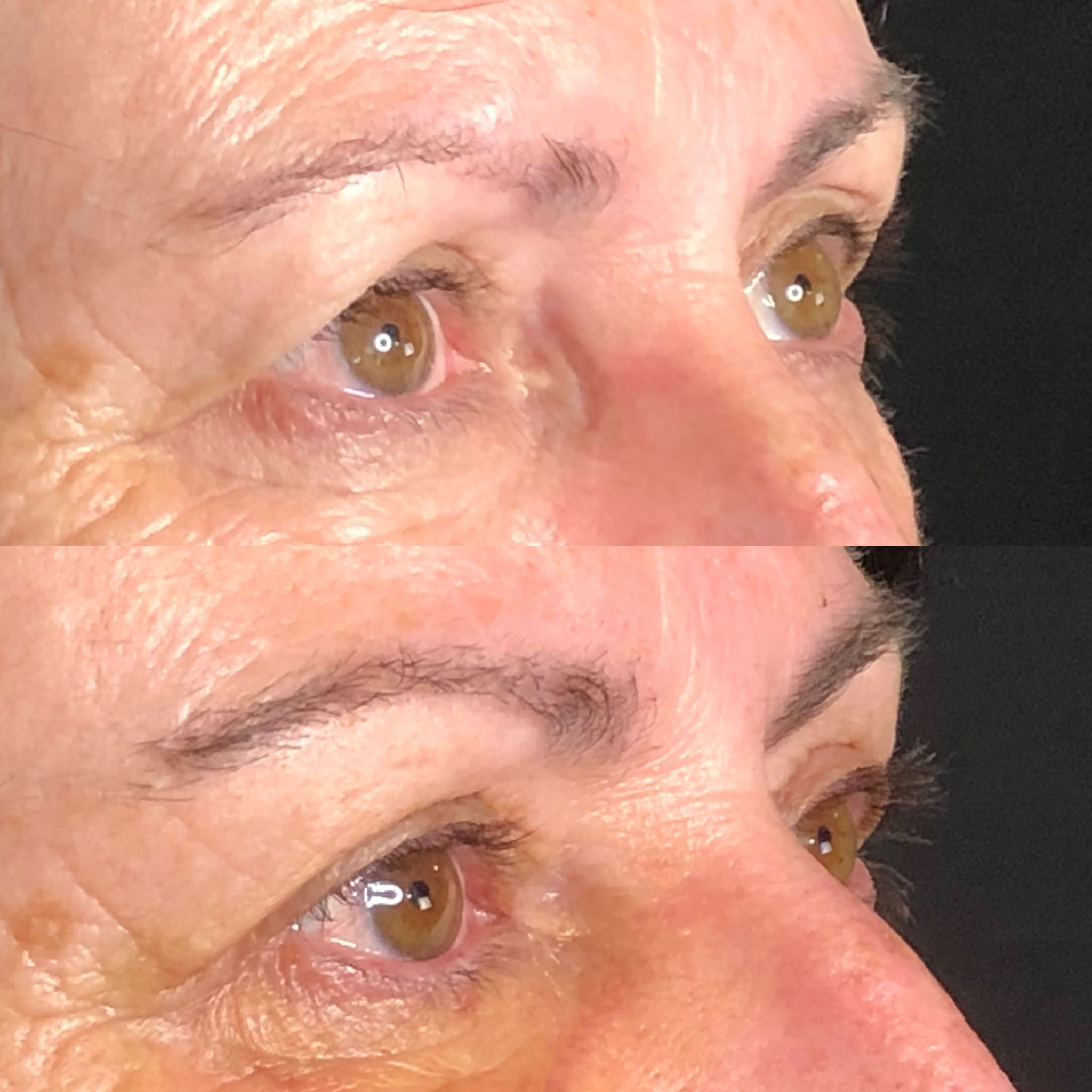 B... - Dr. Sebastian Rios - Cirugía Facial y Medicina Estética