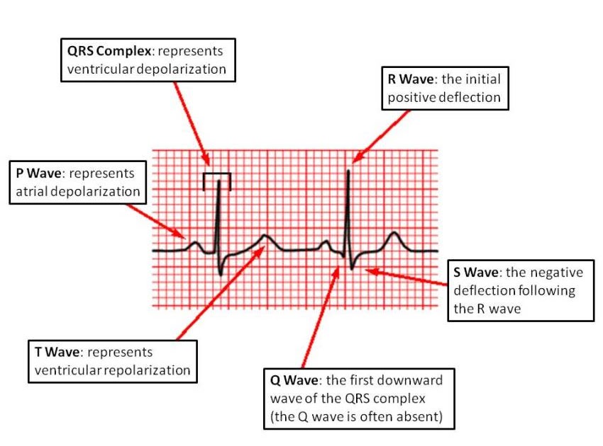 MedicTests.com - Great quick reference on what each wave means on an ...