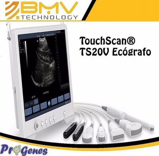 Progenes S.A - Producto:TouchScan® TS20V Ecógrafo. . ¿Que...